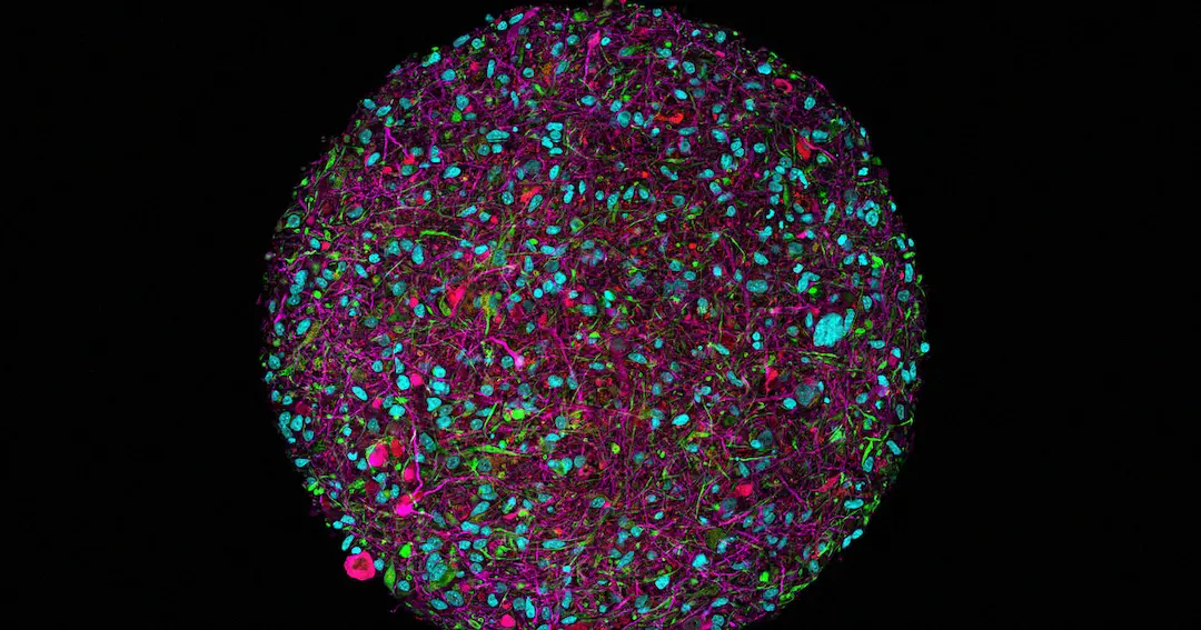 scientists-biocomputers-lab-grown-minibrains.webp